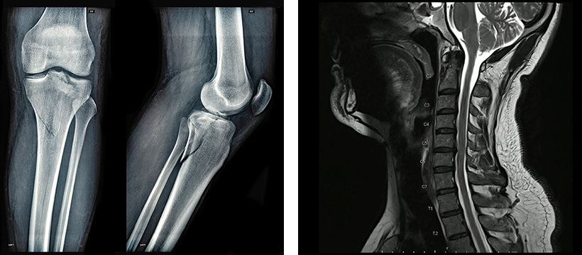 MRI画像検査予約